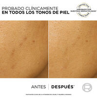 Bright Reveal Peeling Exfoliante Anti-Manchas  25ml-218786 Bright Reveal Peeling Exfoliante Anti-Manchas  25ml-218786 6